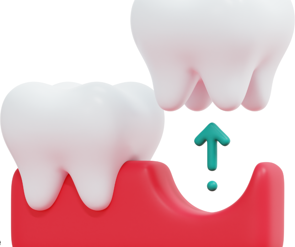 Tooth Extractions in Phoenix